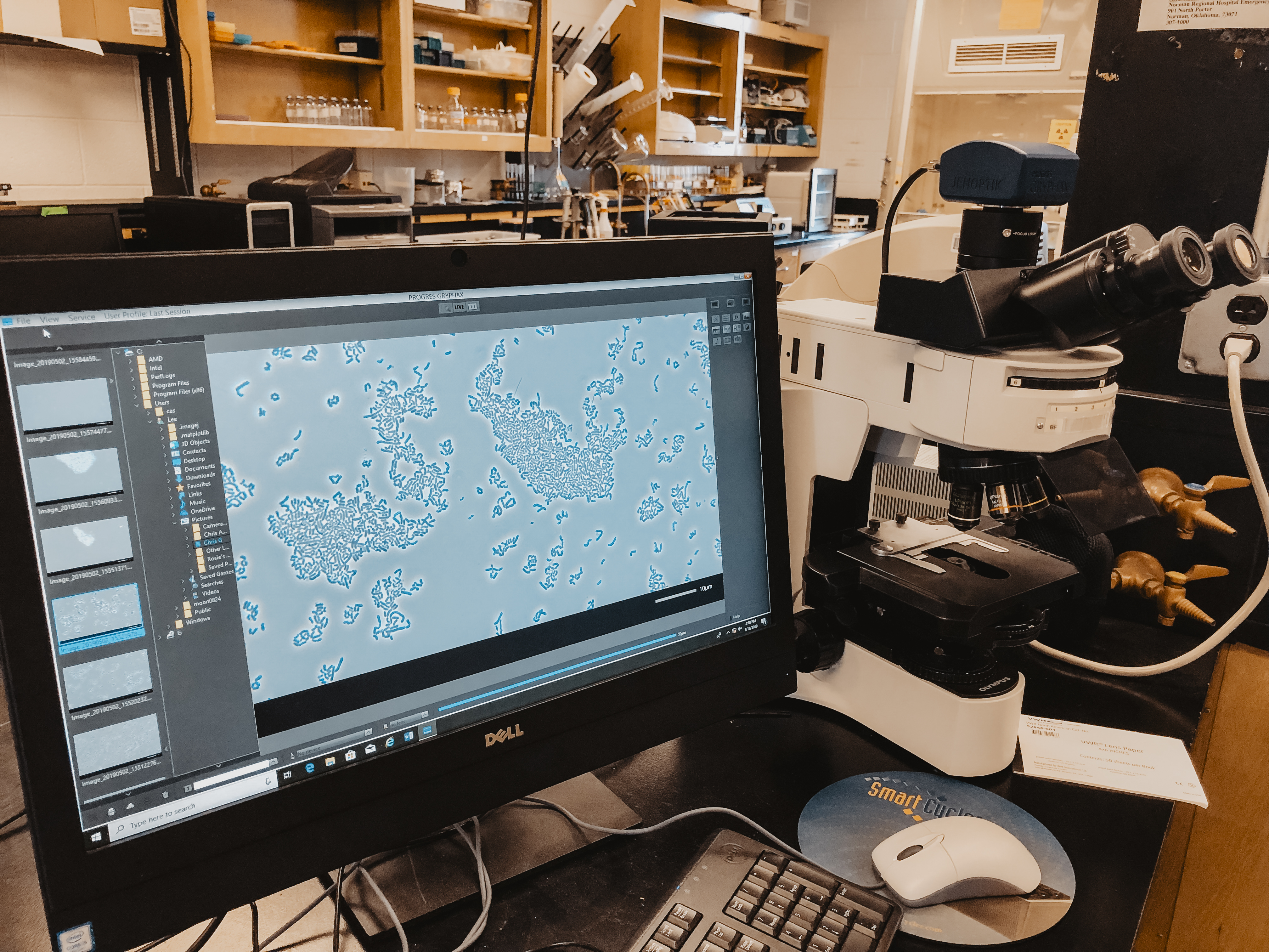 Microscope and image of a methane-consuming microbial consortium from one of our enrichment cultures