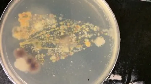 Bacterial growth from leaf 
